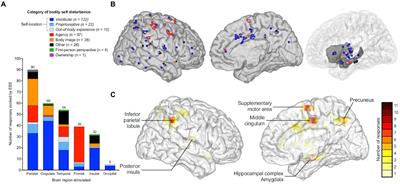 Vertiginous epilepsy in the pediatric population